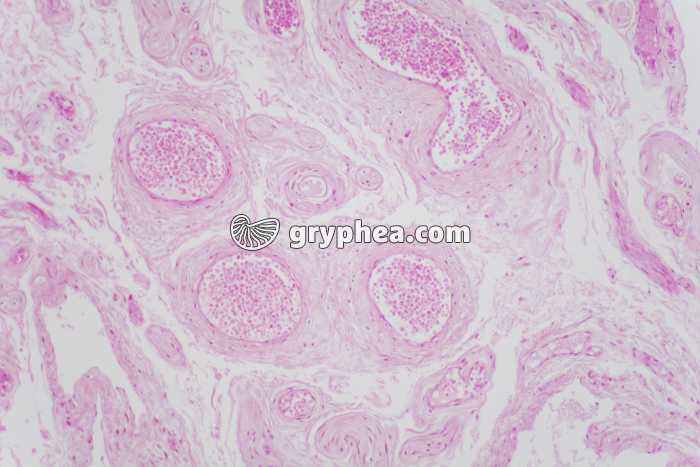 Pénis x40 - gryphea.com